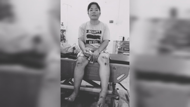 Korban begal mengalami luka-luka. [Istimewa]