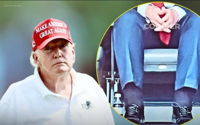Dikabarkan Sakit, Ini Diagnosa yang Diderita Presiden AS Donald Trump!