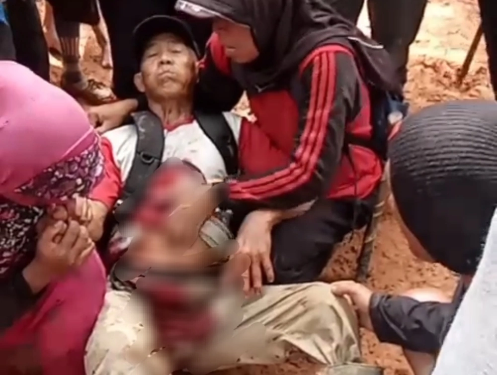 Petani mengalami luka tembak. [Ist]