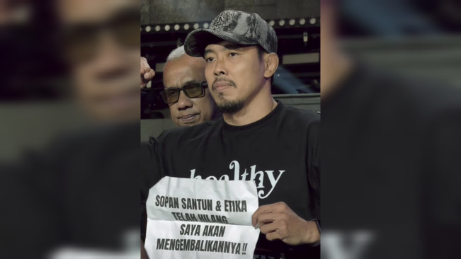 Rudy Golden Boy Alami Luka Lecet Usai Digampar Paris Pernandes: Udah Kurang Ajar Nih