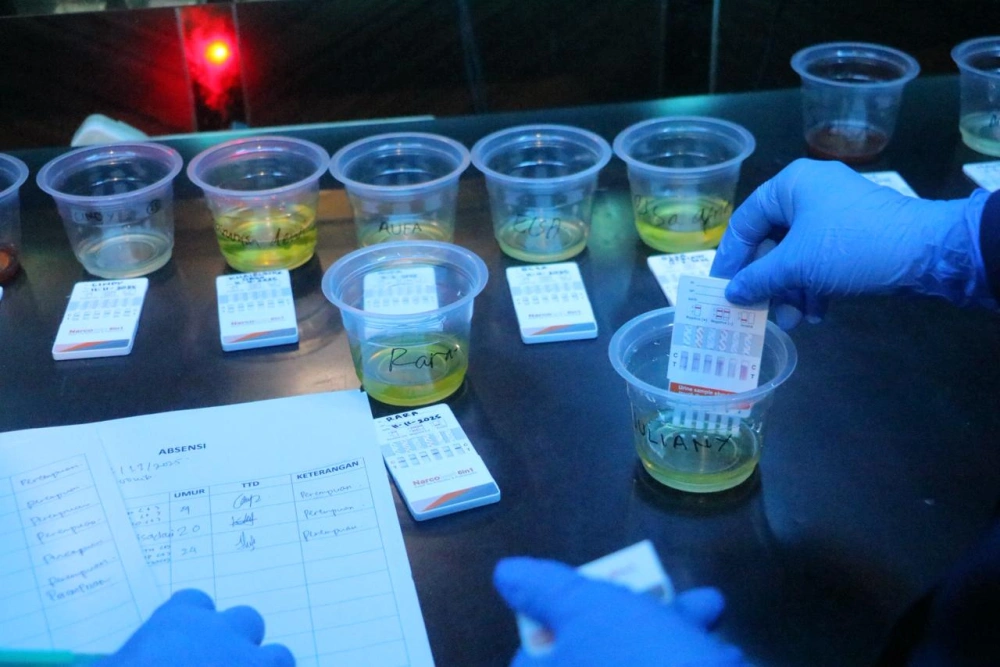 Ilustrasi tes urine narkoba. [Istimewa]