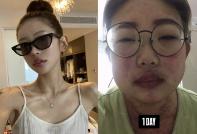 Perjuangan Jun Hee turunkan berat badan (AllKpop)