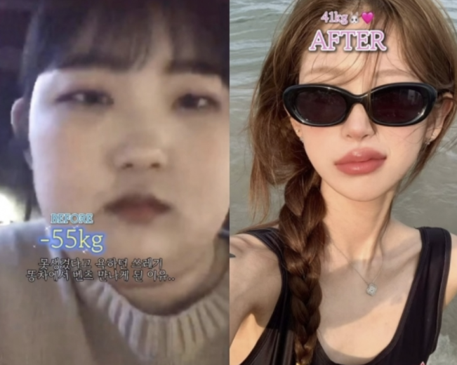 perubahan Jun Hee (Allkpop)