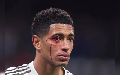 Real Madrid Hancur Lebur Dibantai Celta Vigo, Cedera dan Kartu Merah Bertebaran