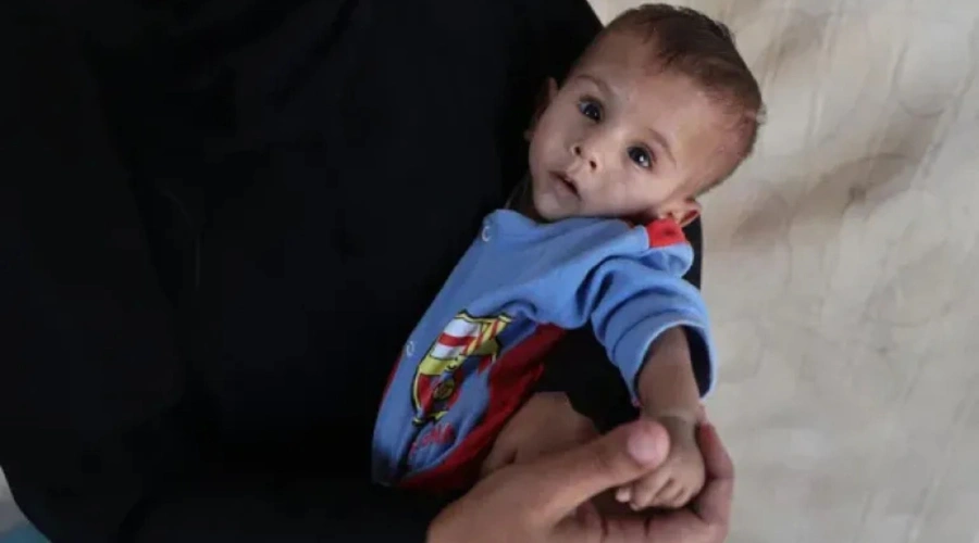 Generasi Baru Palestina Hancur, UNICEF Ungkap Kenyataan Pahit Malnutrisi Bayi dan Ibu Hamil di Gaza