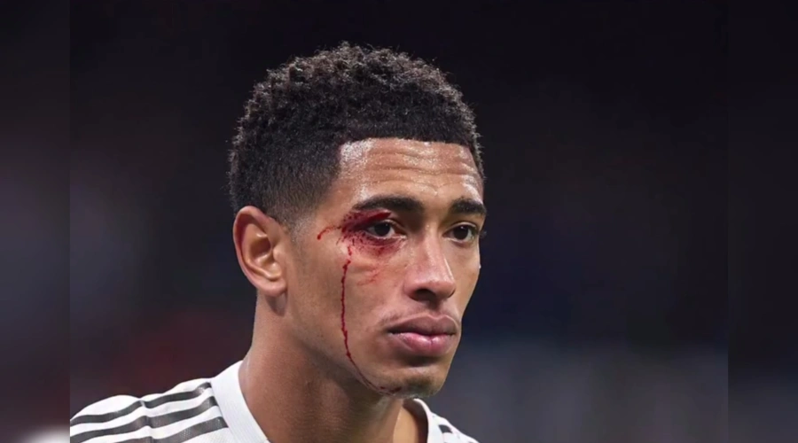 Real Madrid Hancur Lebur Dibantai Celta Vigo, Cedera dan Kartu Merah Bertebaran