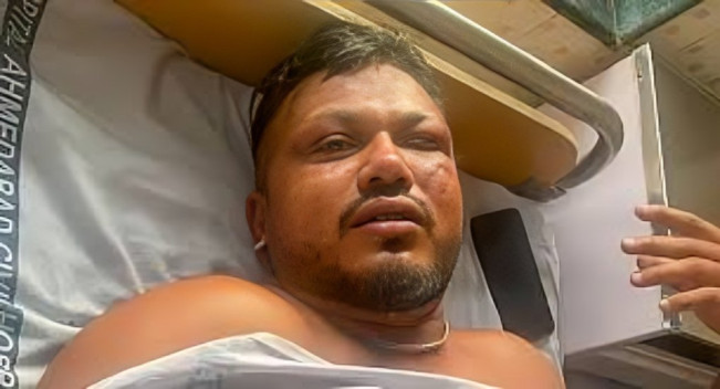 Vishwash Kumar Ramesh, satu satunya penumpang yang selamat/Foto: tangkap layar