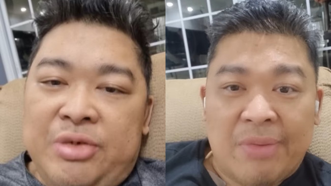 Bak Sudah Firasat, Alvin Lim Pernah Nyatakan Ikhlas Jika Dipanggil Tuhan