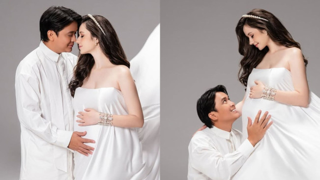 Vika Kolesnaya Istri Billy Syahputra Melahirkan, RS Pastikan Pelayanan Sama dengan Pasien Lain