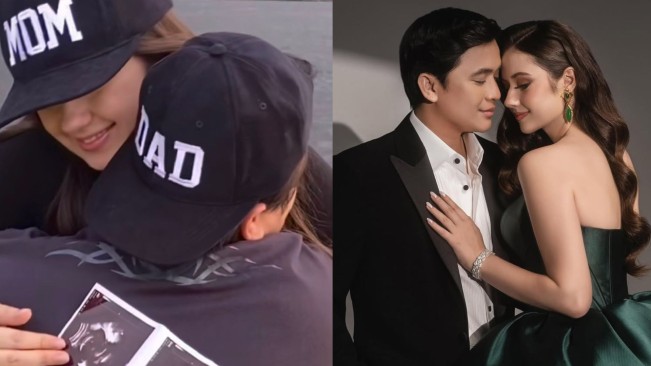 Billy Syahputra Segera Jadi Ayah, Intip 4 Potret Manis Vika Kolesnaya Umumkan Kehamilan