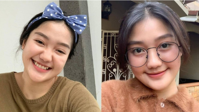 Chandrika Chika Diduga Jambak Rambut dan Tendang Pundak YB Sampai Patah Tulang.