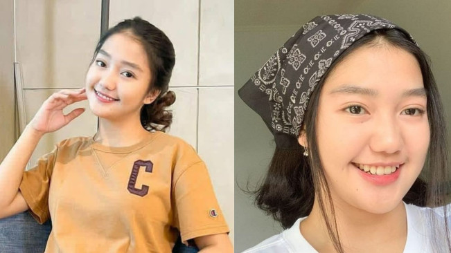 Kronologi Chandrika Chika Bikin YB Babak Belur, Awalnya Saling Pandang Sampai Pukul Pakai Tas