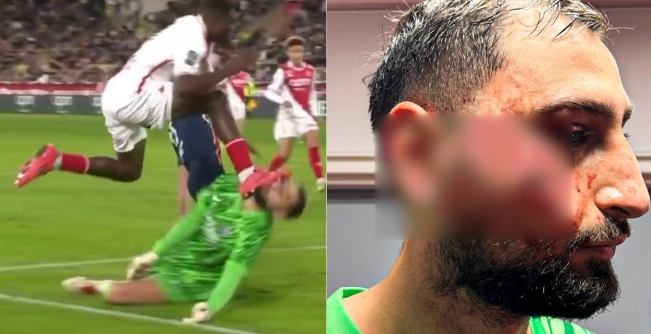 Horor Banget! Detik-Detik Insiden Wajah Donnarumma Kena Pul Sepatu Lawan