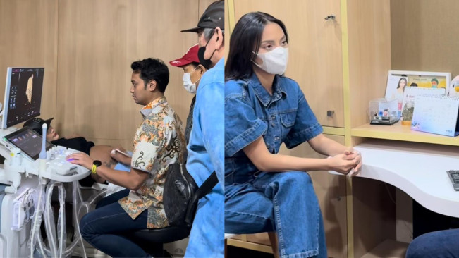 Unggah Momen Periksa Kandungan, Erika Carlina: Apapun Risikonya Aku Terima