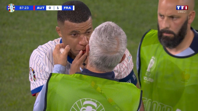 Mbappe Siap Pakai Topeng Kura-Kura Ninja