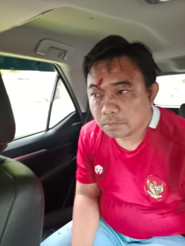 Ketua KNPI yang Laporkan Ferdinand Hutahaen Dikeroyok Orang Tak Dikenal
