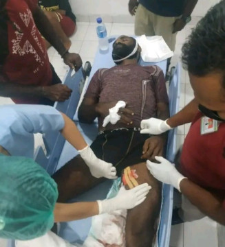 Pascakericuhan Penangkapan Lukas Enembe, Polri Belum Tambah Personel ke PapuaÃ‚Â 