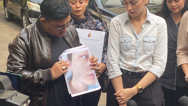 Kimberly Ryder Resmi Laporkan Edward Akbar ke KemenPPPA