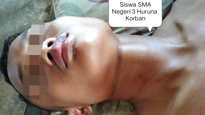 Siswa SMA Negeri 3 Huruna Diduga Dianiaya Guru Hingga Luka Berat