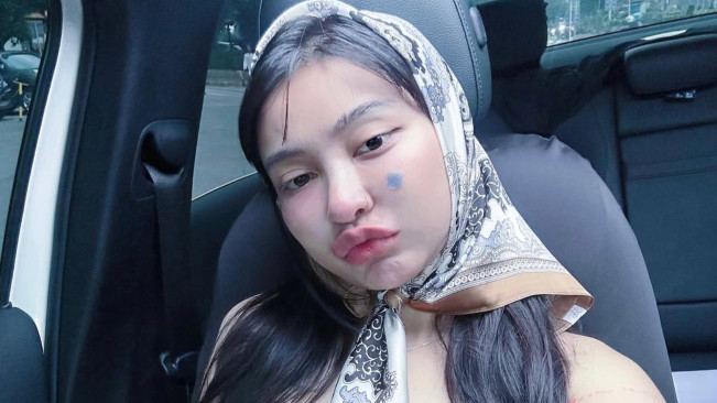 Ponsel Cupi Cupita Hilang di Soetta, Takut Isi Galeri Ketahuan