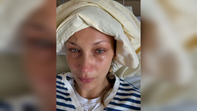 Biodata dan Agama Bella Hadid, Supermodel Dunia yang Berjuang Melawan Penyakit Lyme Disease