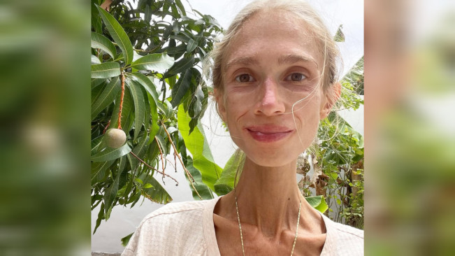 Kisah Karolina Krzyzak, Wanita 27 Tahun yang Meninggal Dunia Usai Jalani Diet Buah Ekstrem di Bali