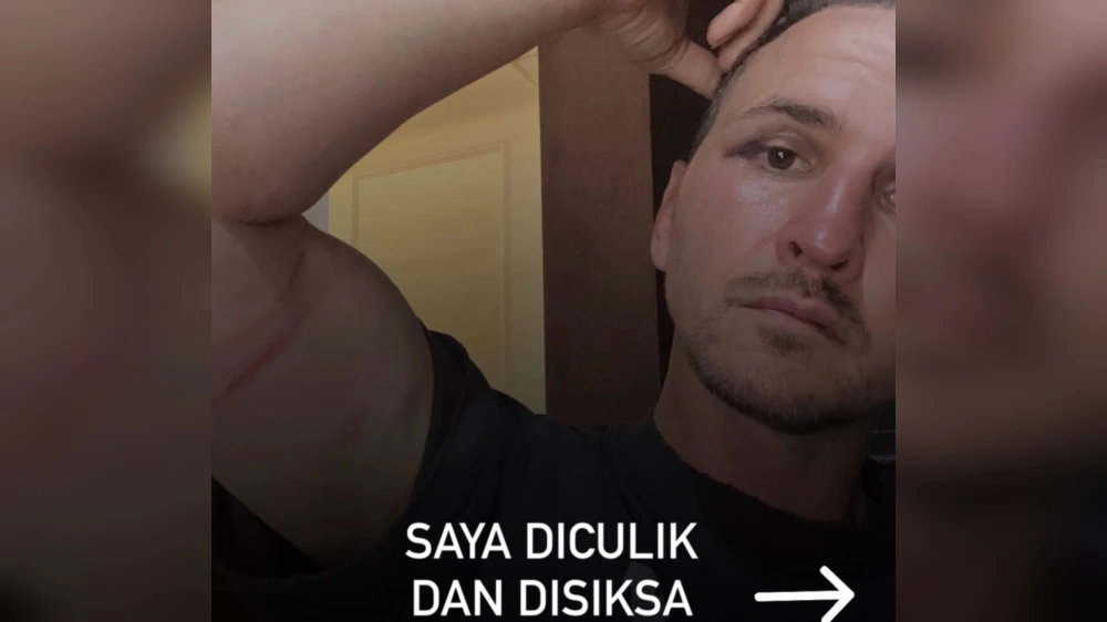 Sergei Domogatskii ngaku diculik dan disiksa. [Instagram]