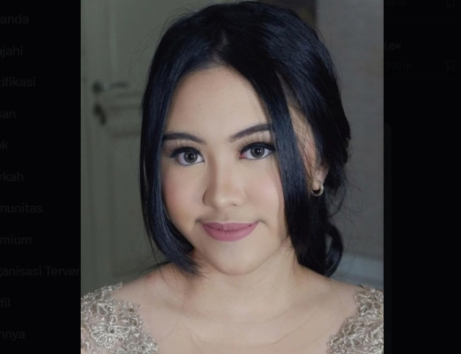 Bocor! Rekaman Suara Sri Meiliana, Ibu Lady Aurellia Ancam Dokter Koas: Kamu Jangan Macam-macam, Saya Orang Komering Asli!