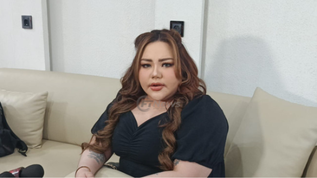 Turunkan Berat Badan, Lisa Mariana Habiskan Ratusan Juta Operasi Bariatrik