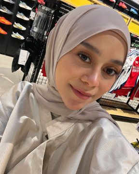 Lesti Kejora dituduh membawakan lagu ciptaan Yonni Dores tanpa izin sejak 2017. (Instagram/@lestikejora)