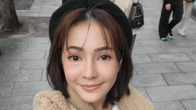 Pantas Makin Cantik, Maya Septha Jalani Operasi Plastik di Bagian Kantung Mata dan Hidung