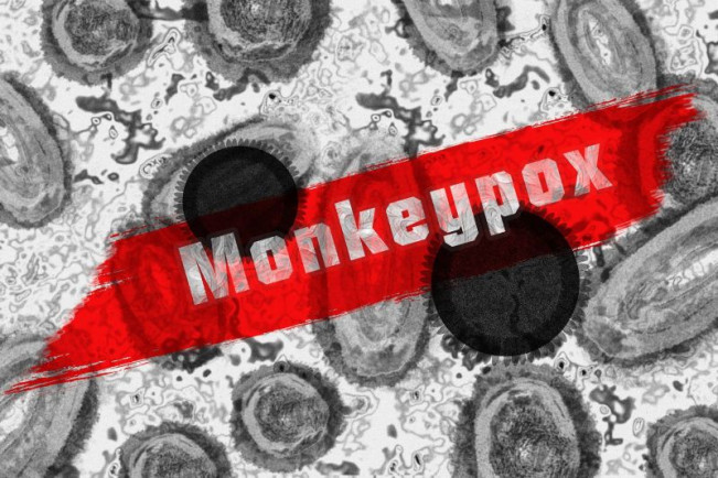 Mpox Menyebar ke Tangsel dan Bandung, Total Jadi 24 Kasus!