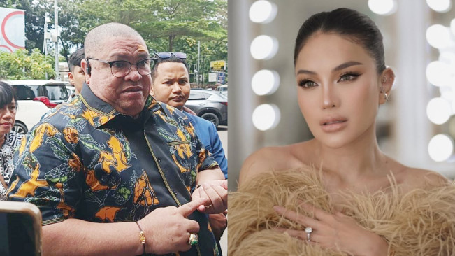 Pelipis Kirinya Dibalut Plester, Begini Penampilan Terbaru Razman Arif Nasution Usai Dianiaya Nikita Mirzani