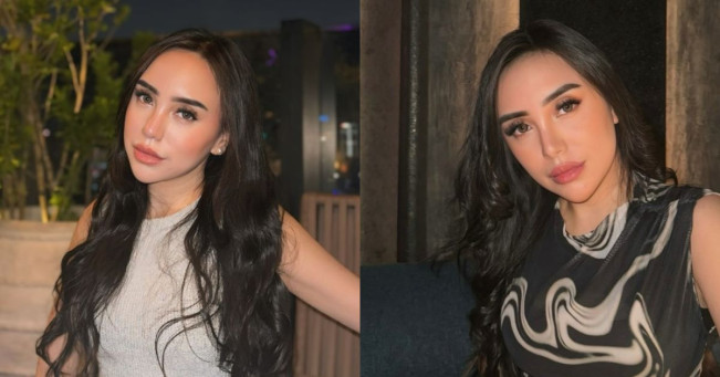 Usai Pindah Agama, Salmafina Sunan Fokus Ngurus Anjing Larry Sakit IVDD