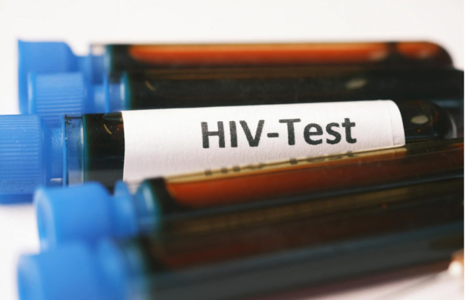 Hasil Testing HIV di Riau: Ditemukan 1.151 Kasus Positif, Terbanyak karena Hubungan Seksual Sejenis