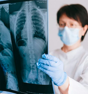 Ilustrasi Covid menyerang paru/Foto: Anna Shvets, pexels.com