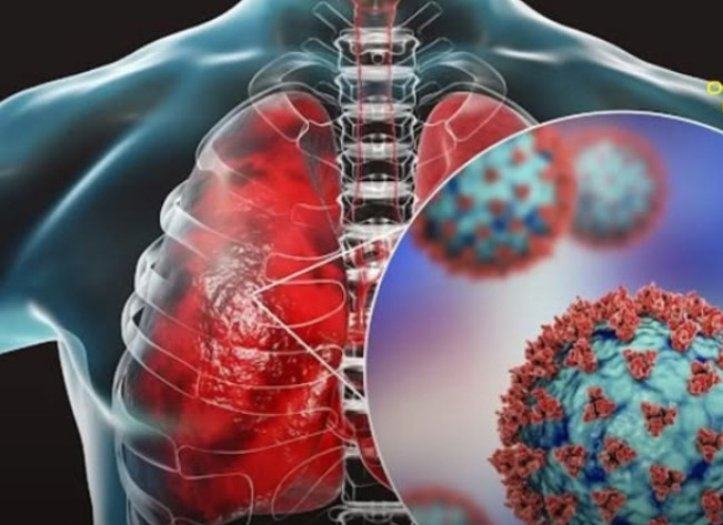 Mari Kenali dan Simak Cara Pencegahan HMPV, Virus yang Mewabah di China dan Malaysia