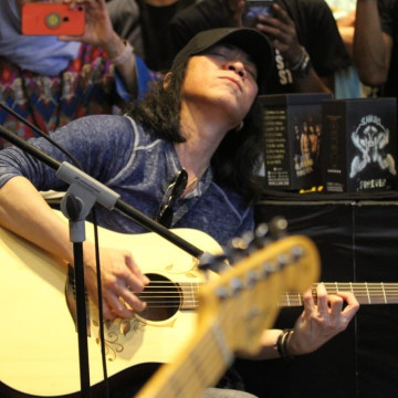 Tidak Hanya Abdee Slank, Berikut Deretan Artis yang Juga Terkena Serangan Autoimun!