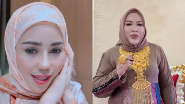 Suami Fenny Frans, Mira Hayati dan Agus Salim Jadi Tersangka Kasus Skincare Merkuri