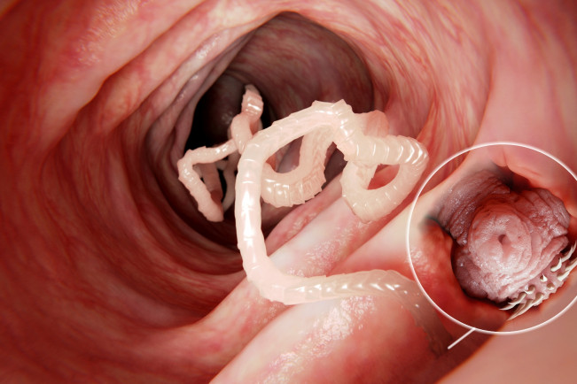 Cegah Infeksi Cacing Pita dengan Cuci Tangan!