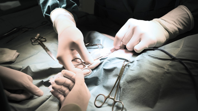 Transplantasi Organ dari Hewan ke Manusia Dekati Titik Cerah