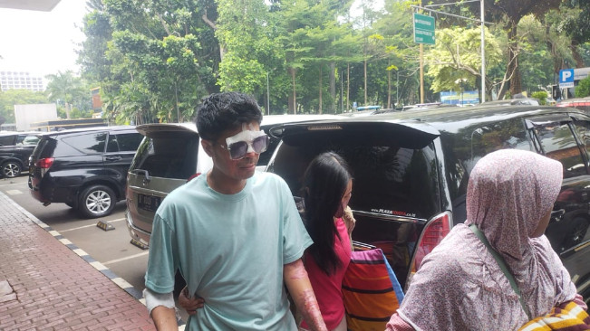 Balada Agus Salim! Jadi Korban Penyiraman Air Keras Lalu Buta, Kini Mengaku Bisa Melihat Meski Rabun