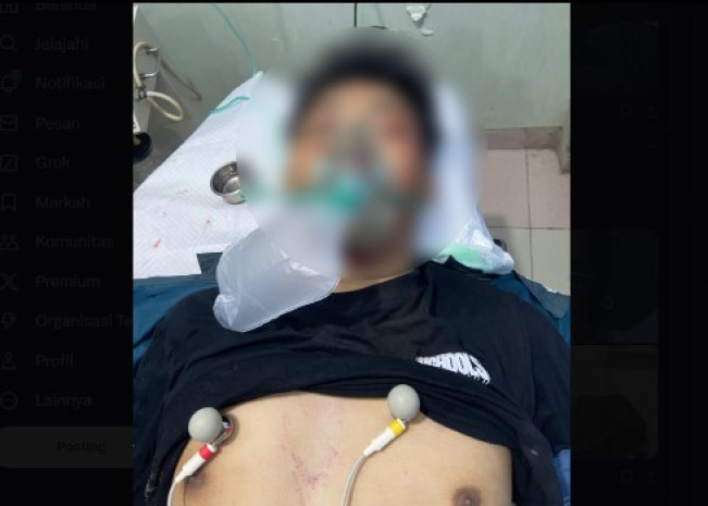 Kronologi Fathir Bobotoh Persib Meninggal Dunia: Akibat Kecelakaan, Bukan Sweeping!