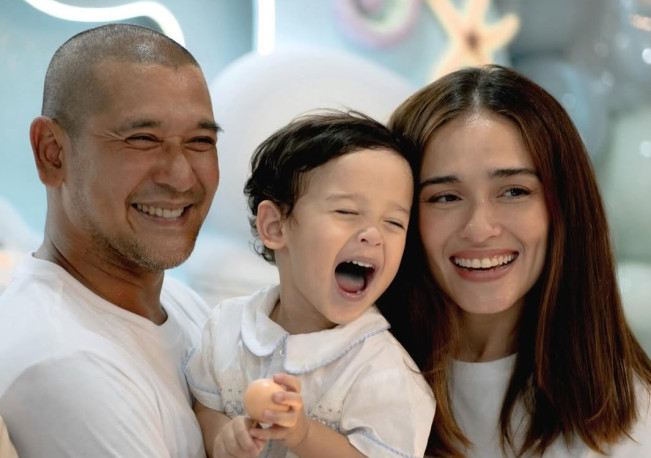 Lika-liku Hidup Yasmine Wildblood: Redup Setelah Jadi Menantu Japto Soerjosoemarno