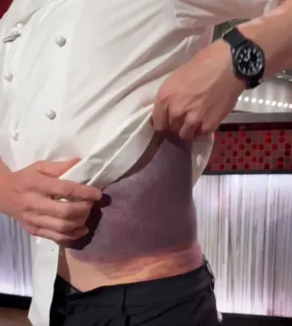 Chef Gordon Ramsay Alami Kecelakaan Hebat saat Bersepeda