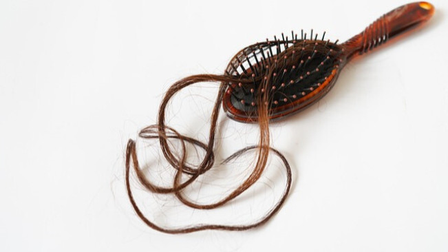 Normalkah Rambut Rontok saat Keramas? 4 Hal Berikut Bisa Jadi Penyebabnya