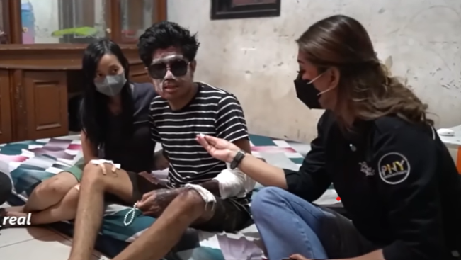 Deretan Kasus Penyiraman Air Keras yang Viral di Indonesia: Agus Salim Bukan yang Pertama