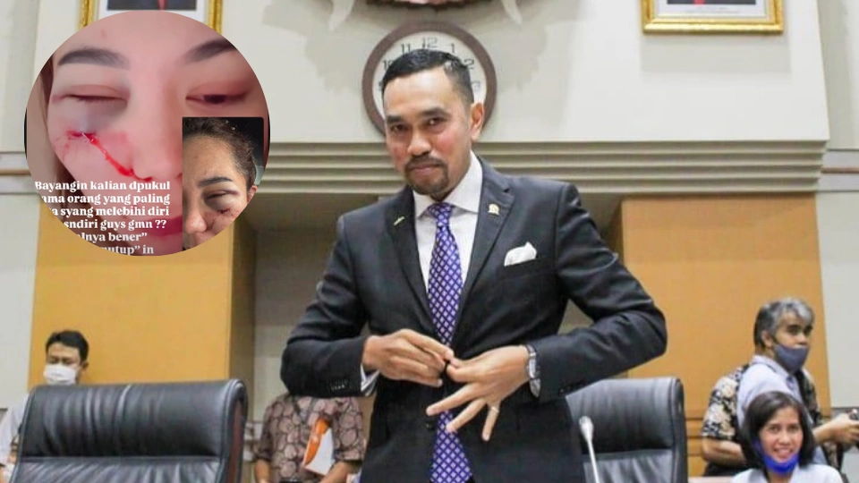 Kasus Selvyta Memanas, Ahmad Sahroni Minta Polri Segera Amankan DJ Alentio