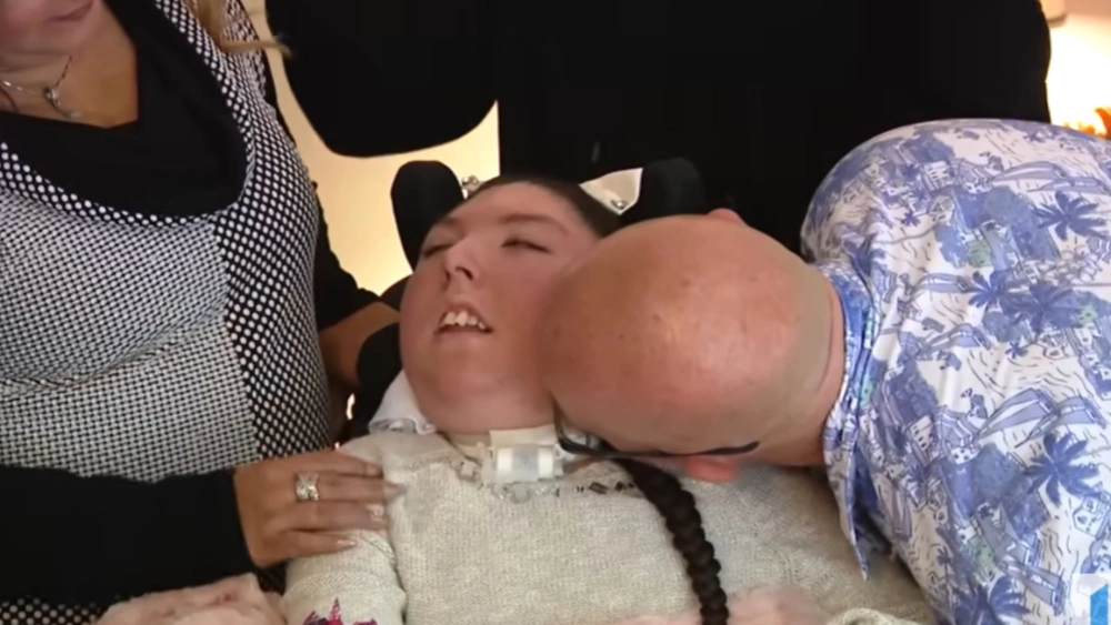 Perempuan Lahir Tanpa Otak Ulang Tahun Ke-20, Dulu Divonis Dokter Berumur Kurang 4 Tahun