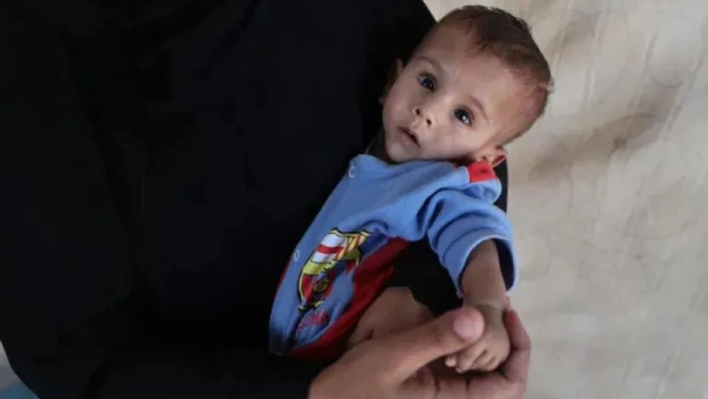 Generasi Baru Palestina Hancur, UNICEF Ungkap Kenyataan Pahit Malnutrisi Bayi dan Ibu Hamil di Gaza